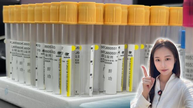 中国最新成果：一管血就能精准识别早期肝癌