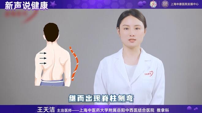 良好站姿能预防青少年脊柱侧弯吗