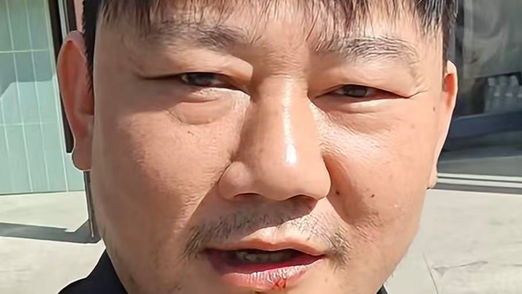 张雪新发型意外走红 网友扎堆玩梗修图