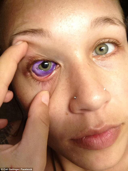 加拿大模特给眼球纹身结果流紫色眼泪眼睛失明