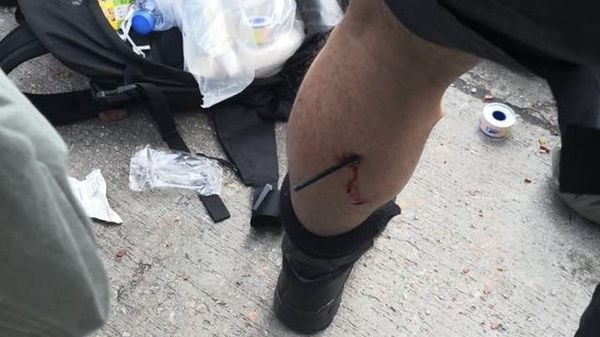 香港警方:暴徒向警方射箭 一名警员中箭受伤香港警方:过去一周共拘捕